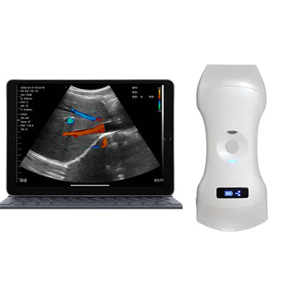 [192 ELEMENT] Wireless Ultrasound Probe 3 in 1