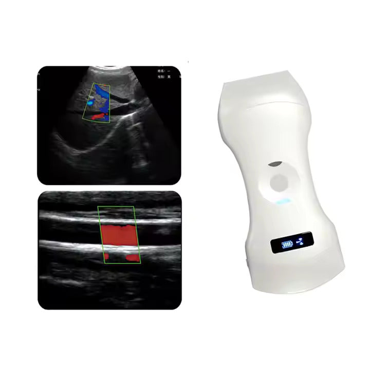 [192 ELEMENT] Wireless Ultrasound Probe 3 in 1