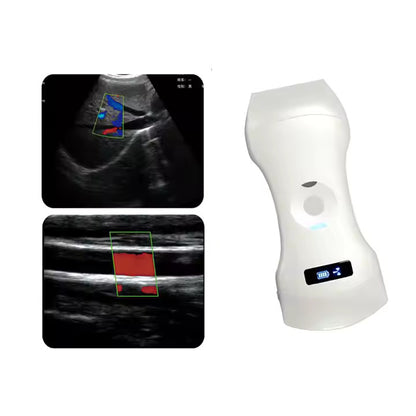 [192 ELEMENT] Wireless Ultrasound Probe 3 in 1