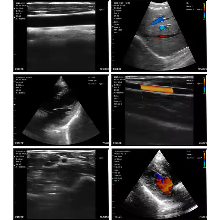 [192 ELEMENT] Wireless Ultrasound Probe 3 in 1